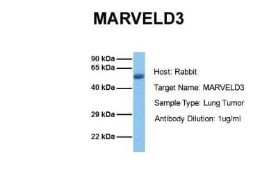 Western Blot: MARVELD3 Antibody [NBP1-59494]