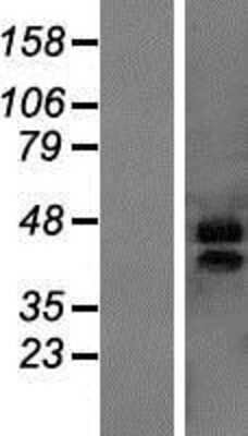 Western Blot: MARVELD3 Overexpression Lysate [NBP2-05854]