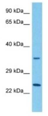 Western Blot: MAS-related GPR member A5 Antibody [NBP3-10265]