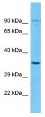 Western Blot: MAS-related GPR member A7 Antibody [NBP3-10263]