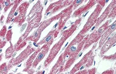 Immunohistochemistry-Paraffin: Mas Antibody [NBP1-60091]