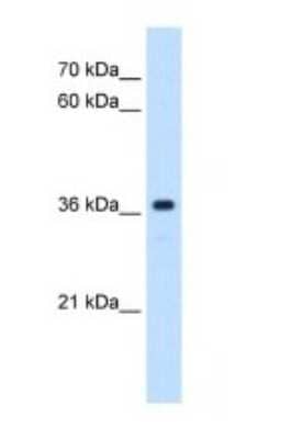 Western Blot: Mas Antibody [NBP1-60091]