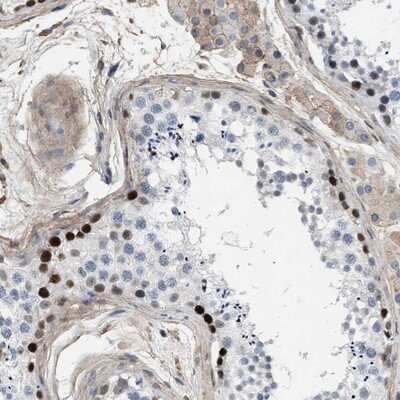 Immunohistochemistry-Paraffin: MAS1L Antibody [NBP1-85157]