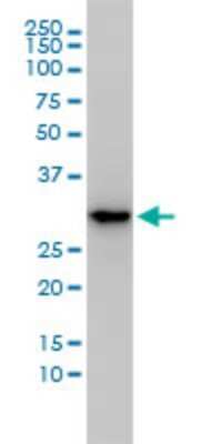 Western Blot: MASA Antibody (3C1-1D5) [H00058478-M01]