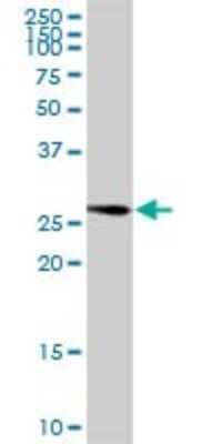 Western Blot: MASA Antibody [H00058478-D01P]