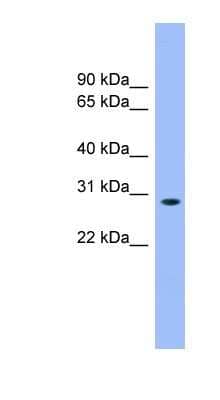 Western Blot: MASA Antibody [NBP1-55361]