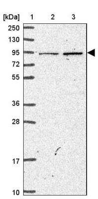 Western Blot: MASL1 Antibody [NBP2-30382]