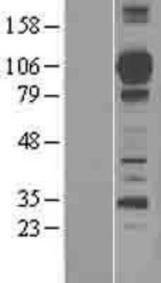 Western Blot: Complement Factor MASP1 Overexpression Lysate [NBL1-12905]