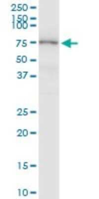 Western Blot: MASP2 Antibody [H00010747-D01P]