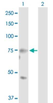 Western Blot: MASP2 Antibody [H00010747-D01P]