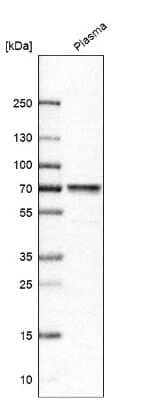 Western Blot: MASP2 Antibody [NBP1-81259]