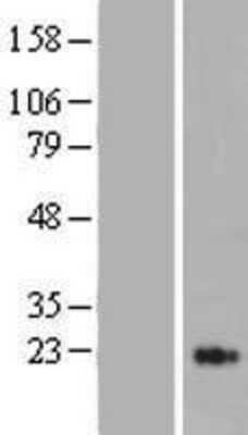 Western Blot: MASP2 Overexpression Lysate [NBP2-05582]