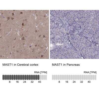 Immunohistochemistry-Paraffin: MAST1 Antibody [NBP2-62681]