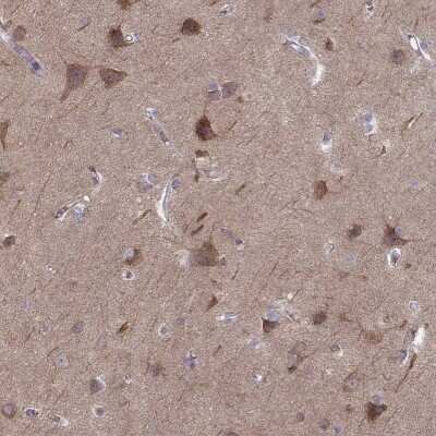 Immunohistochemistry-Paraffin: MAST1 Antibody [NBP2-62681]