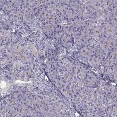 Immunohistochemistry-Paraffin: MAST1 Antibody [NBP2-62681]