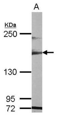 Western Blot: MAST1 Antibody [NBP2-17228]