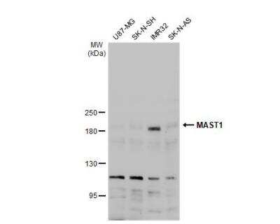 Western Blot: MAST1 Antibody [NBP2-17228]