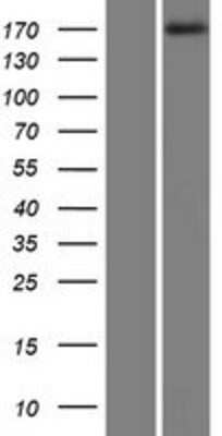 Western Blot: MAST1 Overexpression Lysate [NBP2-07234]