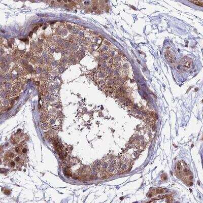 Immunohistochemistry-Paraffin: MAST205 Antibody [NBP1-87899]