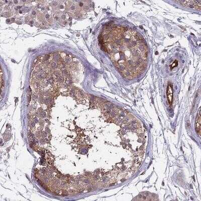 Immunohistochemistry-Paraffin: MAST205 Antibody [NBP1-87900]