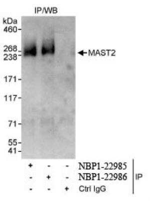 Immunoprecipitation: MAST205 Antibody [NBP1-22985]