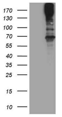 Western Blot: MAST205 Antibody (OTI3A5)Azide and BSA Free [NBP2-72592]