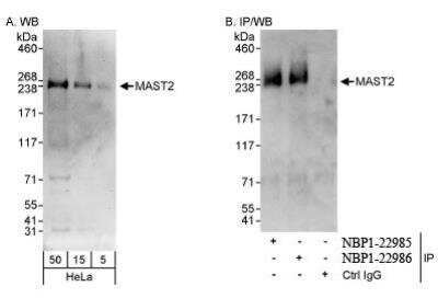 Western Blot: MAST205 Antibody [NBP1-22986]