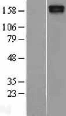 Western Blot: MAST205 Overexpression Lysate [NBL1-12907]