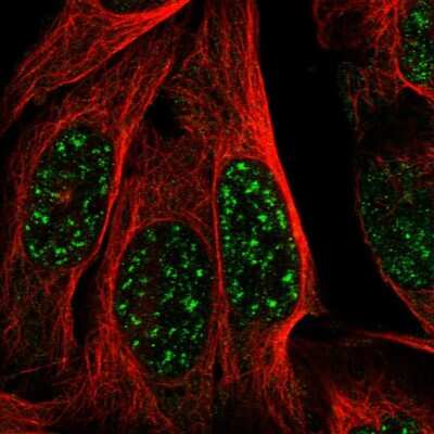 Immunocytochemistry/ Immunofluorescence: MAST3 Antibody [NBP1-82993]