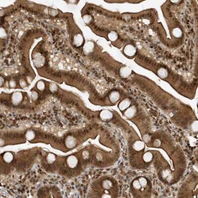 Immunohistochemistry-Paraffin: MAST3 Antibody [NBP1-82992]