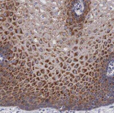 Immunohistochemistry-Paraffin: MAST4 Antibody [NBP1-83017]