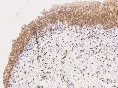 Immunohistochemistry-Paraffin: MAST4 Antibody [NBP3-06572]