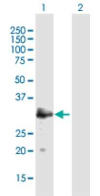 Western Blot: MAST4 Antibody [H00375449-B01P]