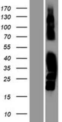 Western Blot: MAST4 Overexpression Lysate [NBP2-04675]