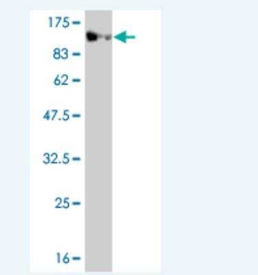 Western Blot: MASTL Antibody (4B4-1B11) [H00084930-M01]