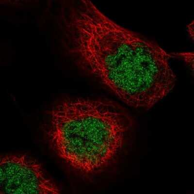 Immunocytochemistry/ Immunofluorescence: MASTL Antibody [NBP2-55023]