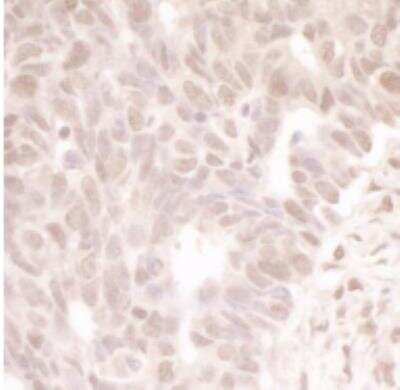 Immunohistochemistry-Paraffin: MASTL Antibody [NBP1-22987]