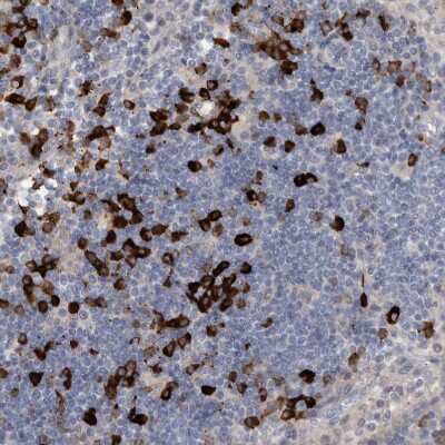 Immunohistochemistry-Paraffin: MASTL Antibody [NBP1-83680]