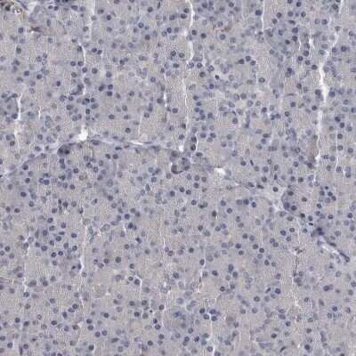 Immunohistochemistry-Paraffin: MASTL Antibody [NBP1-83680]