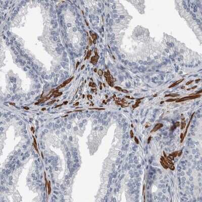 Immunohistochemistry-Paraffin: MASTL Antibody [NBP1-83680]