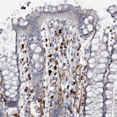 Immunohistochemistry-Paraffin: MASTL Antibody [NBP1-83680]