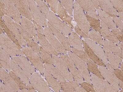 Immunohistochemistry-Paraffin: MASTL Antibody [NBP2-97307]