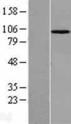 Western Blot: MASTL Overexpression Lysate [NBL1-12908]