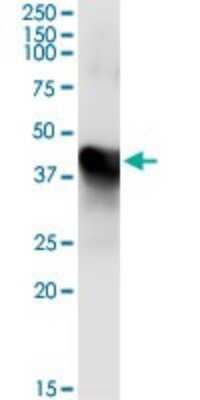Immunoprecipitation: MAT1A Antibody (4D11) [H00004143-M01]