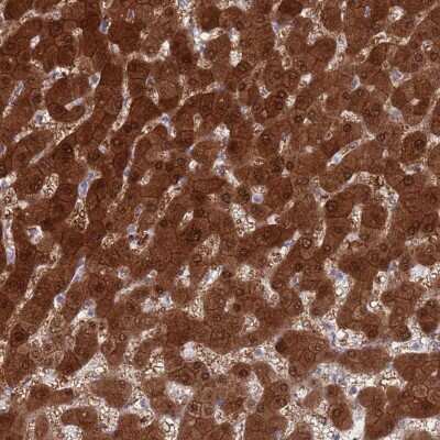 Immunohistochemistry-Paraffin: MAT1A Antibody [NBP2-33533]