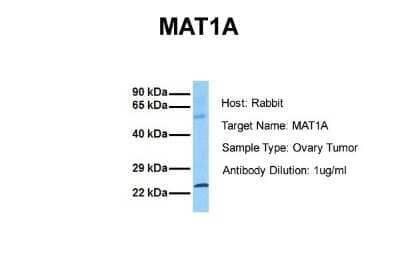 Western Blot: MAT1A Antibody [NBP1-54893]