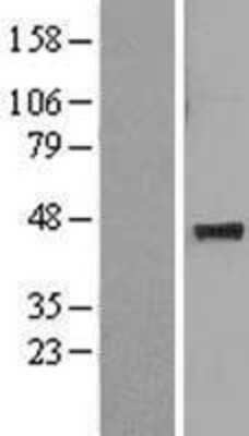 Western Blot: MAT1A Overexpression Lysate [NBL1-12909]