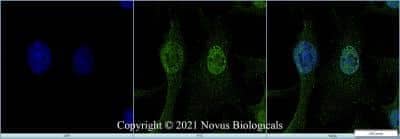 Immunocytochemistry/ Immunofluorescence: MAT2A Antibody - BSA Free [NB110-94158]