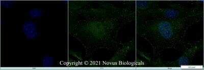 Immunocytochemistry/ Immunofluorescence: MAT2A Antibody - BSA Free [NB110-94158]