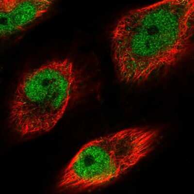 Immunocytochemistry/ Immunofluorescence: MAT2A Antibody [NBP1-92100]